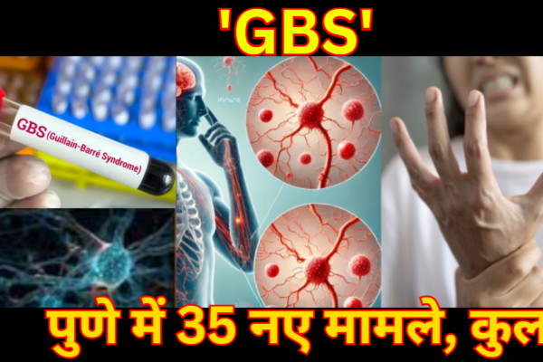 GBS